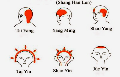 www.ElementalChanges.com Headache Patterns in TCM